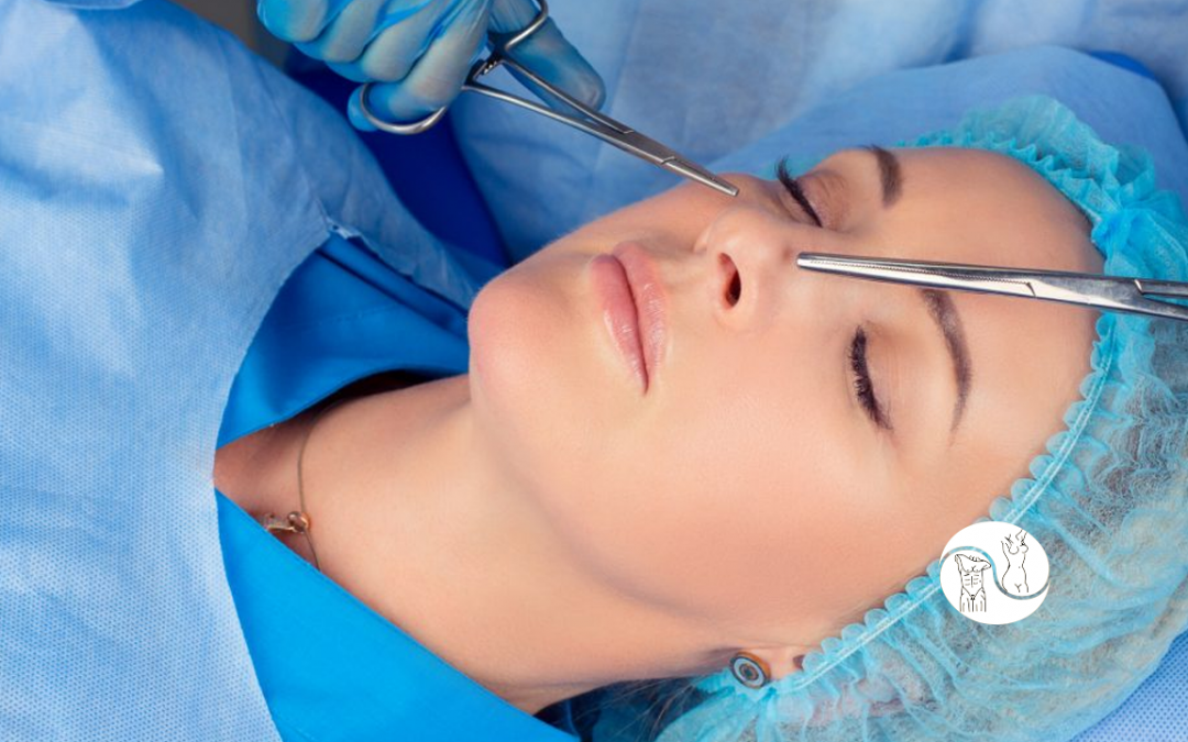 Rinoplastia: um detalhe que faz uma grande diferença