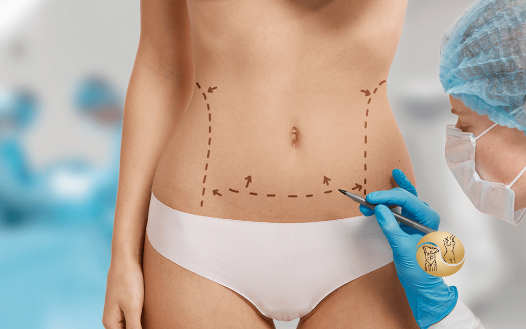 Tudo que você precisa saber sobre a Lipoaspiração