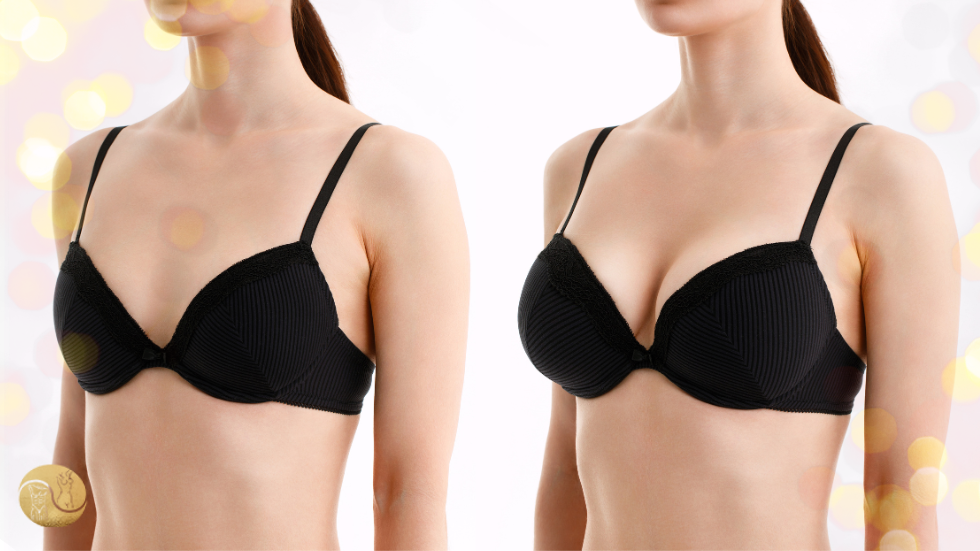 MAMOPLASTIA ESTRUTURADA: O QUE É E POR QUE TANTAS MULHERES ESTÃO ESCOLHENDO